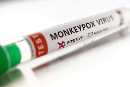 Malta Reports Second Monkeypox Case of 2024